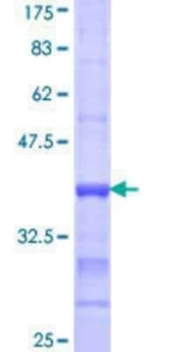Novus Biologicals Recombinant Human ACSL1 GST (N-Term) Protein 10 &mu;g | Buy Online | Novus Biologicals&trade; | Fisher Scientific