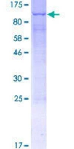 Novus Biologicals Recombinant Human ACSL3 GST (N-Term) Protein 2 &mu;g | Buy Online | Novus Biologicals&trade; | Fisher Scientific