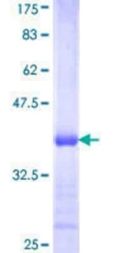 Novus Biologicals Recombinant Human ACSL3 GST (N-Term) Protein 10 &mu;g | Buy Online | Novus Biologicals&trade; | Fisher Scientific