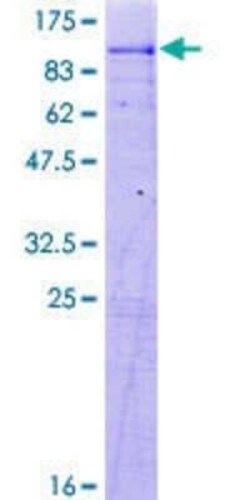 Novus Biologicals Recombinant Human FACL4 GST (N-Term) Protein 2 &mu;g | Buy Online | Novus Biologicals&trade; | Fisher Scientific