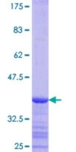 Novus Biologicals Recombinant Human FACL4 GST (N-Term) Protein 10 &mu;g | Buy Online | Novus Biologicals&trade; | Fisher Scientific