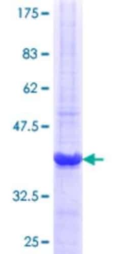 Novus Biologicals Recombinant Human FANCB GST (N-Term) Protein 10 &mu;g | Buy Online | Novus Biologicals&trade; | Fisher Scientific