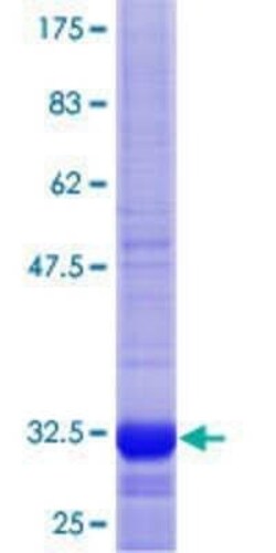 Novus Biologicals Recombinant Human FANCF GST (N-Term) Protein 10 &mu;g | Buy Online | Novus Biologicals&trade; | Fisher Scientific
