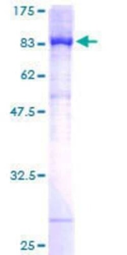 Novus Biologicals Recombinant Human FANCG GST (N-Term) Protein 25 &mu;g | Buy Online | Novus Biologicals&trade; | Fisher Scientific