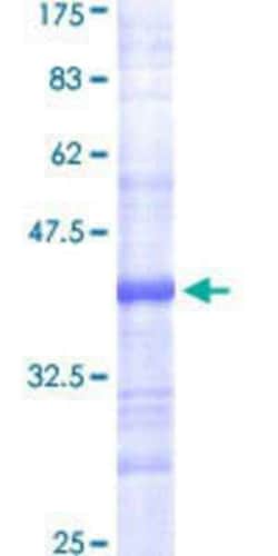 Novus Biologicals&trade;&nbsp;Recombinant Human Fatty Acid Synthase/FASN GST (N-Term) Protein