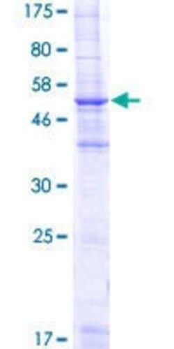 Novus Biologicals Recombinant Human Fc epsilon RI beta/MS4A2 GST (N-Term) Protein 10 &mu;g | Buy Online | Novus Biologicals&trade; | Fisher Scientific