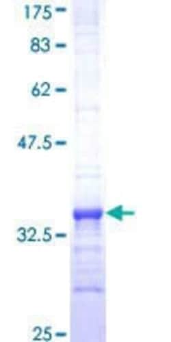 Novus Biologicals Recombinant Human Fc epsilon RI beta/MS4A2 GST (N-Term) Protein 25 &mu;g | Buy Online | Novus Biologicals&trade; | Fisher Scientific