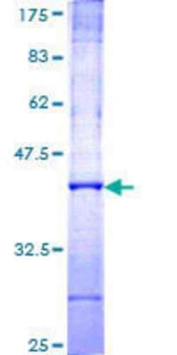 Novus Biologicals Recombinant Human FKTN GST (N-Term) Protein 10 &mu;g | Buy Online | Novus Biologicals&trade; | Fisher Scientific