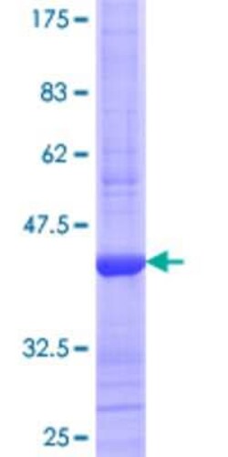 Novus Biologicals&trade;&nbsp;Recombinant Human FDPS GST (N-Term) Protein