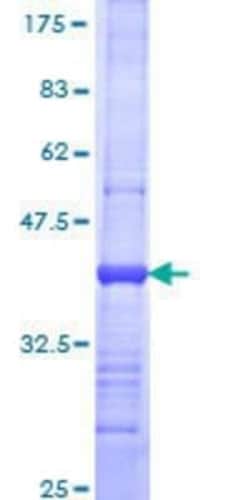 Novus Biologicals Recombinant Human FECH GST (N-Term) Protein 25 &mu;g | Buy Online | Novus Biologicals&trade; | Fisher Scientific
