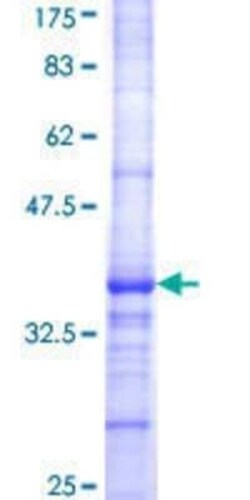 Novus Biologicals Recombinant Human FGF-11 GST (N-Term) Protein 25 &mu;g | Buy Online | Novus Biologicals&trade; | Fisher Scientific