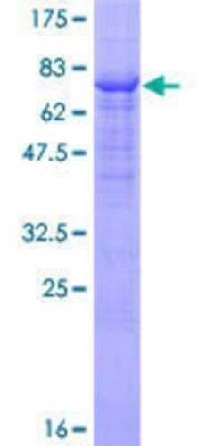 Novus Biologicals Recombinant Human Fgr GST (N-Term) Protein 10 &mu;g | Buy Online | Novus Biologicals&trade; | Fisher Scientific