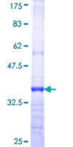 Novus Biologicals Recombinant Human Fgr GST (N-Term) Protein 10 &mu;g | Buy Online | Novus Biologicals&trade; | Fisher Scientific
