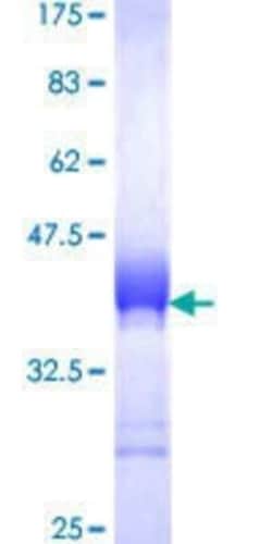 Novus Biologicals Recombinant Human FHL1 GST (N-Term) Protein 25 &mu;g | Buy Online | Novus Biologicals&trade; | Fisher Scientific