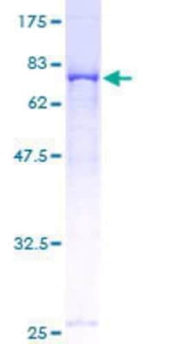 Novus Biologicals Recombinant Human FKBP51/FKBP5 GST (N-Term) Protein 10 &mu;g | Buy Online | Novus Biologicals&trade; | Fisher Scientific