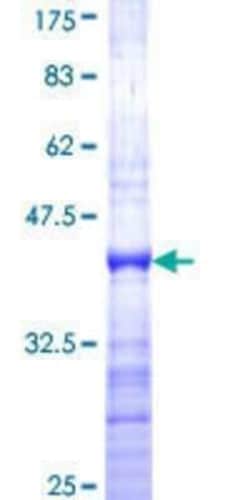 Novus Biologicals Recombinant Human FOXG1 GST (N-Term) Protein 25 &mu;g | Buy Online | Novus Biologicals&trade; | Fisher Scientific