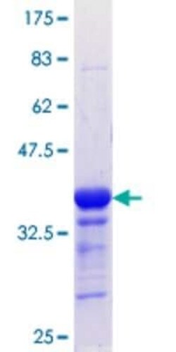 Novus Biologicals Recombinant Human FOXL1 GST (N-Term) Protein 25 &mu;g | Buy Online | Novus Biologicals&trade; | Fisher Scientific