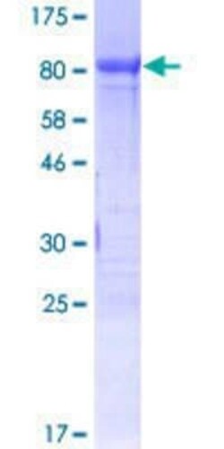 Novus Biologicals Recombinant Human FoxC2 GST (N-Term) Protein 10 &mu;g | Buy Online | Novus Biologicals&trade; | Fisher Scientific