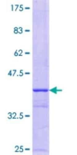 Novus Biologicals Recombinant Human FOXS1 GST (N-Term) Protein 10 &mu;g | Buy Online | Novus Biologicals&trade; | Fisher Scientific