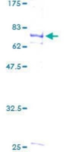Novus Biologicals Recombinant Human FLI1 GST (N-Term) Protein 2 &mu;g | Buy Online | Novus Biologicals&trade; | Fisher Scientific