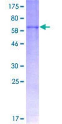 Novus Biologicals Recombinant Human Fibromodulin/FMOD GST (N-Term) Protein 2 &mu;g | Buy Online | Novus Biologicals&trade; | Fisher Scientific