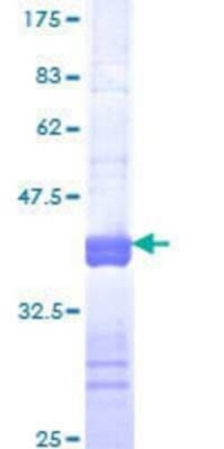 Novus Biologicals Recombinant Human FMRP GST (N-Term) Protein 25 &mu;g | Buy Online | Novus Biologicals&trade; | Fisher Scientific