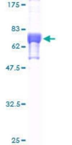 Novus Biologicals Recombinant Human FNTB GST (N-Term) Protein 25 &mu;g | Buy Online | Novus Biologicals&trade; | Fisher Scientific