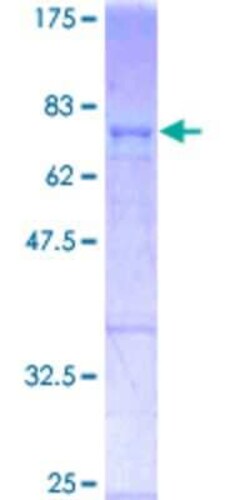 Novus Biologicals Recombinant Human c-Fos GST (N-Term) Protein 25 &mu;g | Buy Online | Novus Biologicals&trade; | Fisher Scientific