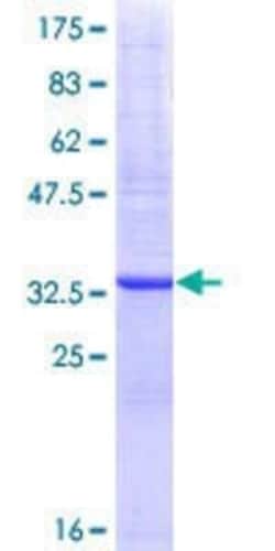 Novus Biologicals Recombinant Human FPGS GST (N-Term) Protein 10 &mu;g | Buy Online | Novus Biologicals&trade; | Fisher Scientific