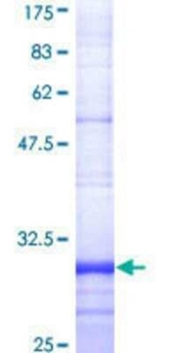 Novus Biologicals Recombinant Human FPRL1/FPR2 GST (N-Term) Protein 10 &mu;g | Buy Online | Novus Biologicals&trade; | Fisher Scientific