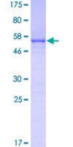 Novus Biologicals Recombinant Human FRG1 GST (N-Term) Protein 25 &mu;g | Buy Online | Novus Biologicals&trade; | Fisher Scientific
