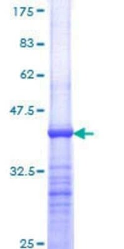 Novus Biologicals Recombinant Human LRH-1/NR5A2 GST (N-Term) Protein 25 &mu;g | Buy Online | Novus Biologicals&trade; | Fisher Scientific