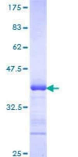 Novus Biologicals Recombinant Human ADAM2 GST (N-Term) Protein 10 &mu;g | Buy Online | Novus Biologicals&trade; | Fisher Scientific