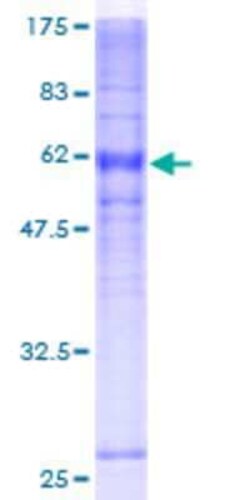 Novus Biologicals Recombinant Human DARC GST (N-Term) Protein 10 &mu;g | Buy Online | Novus Biologicals&trade; | Fisher Scientific