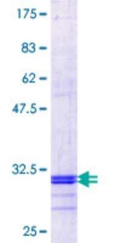 Novus Biologicals Recombinant Human SLC37A4 GST (N-Term) Protein 10 &mu;g | Buy Online | Novus Biologicals&trade; | Fisher Scientific