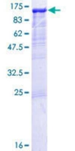 Novus Biologicals Recombinant Human GAB1 GST (N-Term) Protein 25 &mu;g | Buy Online | Novus Biologicals&trade; | Fisher Scientific