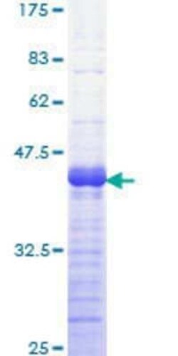 Novus Biologicals Recombinant Human GAB1 GST (N-Term) Protein 25 &mu;g | Buy Online | Novus Biologicals&trade; | Fisher Scientific