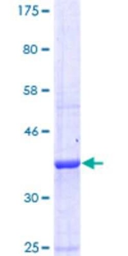 Novus Biologicals Recombinant Human GABA-B R1 GST (N-Term) Protein 10 &mu;g | Buy Online | Novus Biologicals&trade; | Fisher Scientific