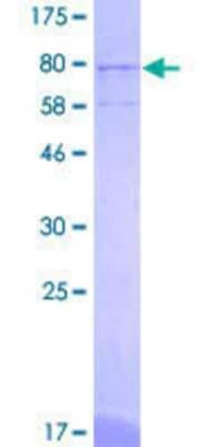 Novus Biologicals Recombinant Human GABPA GST (N-Term) Protein 10 &mu;g | Buy Online | Novus Biologicals&trade; | Fisher Scientific