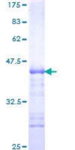 Novus Biologicals Recombinant Human GABPA GST (N-Term) Protein 25 &mu;g | Buy Online | Novus Biologicals&trade; | Fisher Scientific