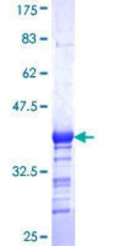 Novus Biologicals Recombinant Human GABPB1 GST (N-Term) Protein 25 &mu;g | Buy Online | Novus Biologicals&trade; | Fisher Scientific