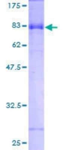 Novus Biologicals Recombinant Human GABA-AR alpha 3 GST (N-Term) Protein 25 &mu;g | Buy Online | Novus Biologicals&trade; | Fisher Scientific