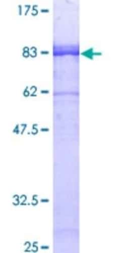 Novus Biologicals Recombinant Human GABA-AR alpha 3 GST (N-Term) Protein 10 &mu;g | Buy Online | Novus Biologicals&trade; | Fisher Scientific
