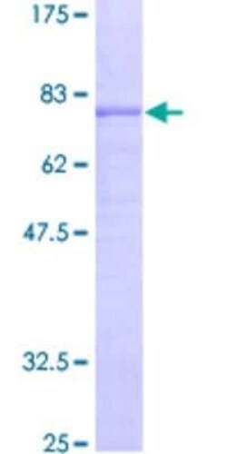Novus Biologicals Recombinant Human GABA-AR alpha 5 GST (N-Term) Protein 25 &mu;g | Buy Online | Novus Biologicals&trade; | Fisher Scientific
