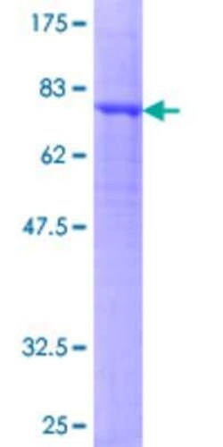 Novus Biologicals Recombinant Human GABA-AR alpha 5 GST (N-Term) Protein 2 &mu;g | Buy Online | Novus Biologicals&trade; | Fisher Scientific