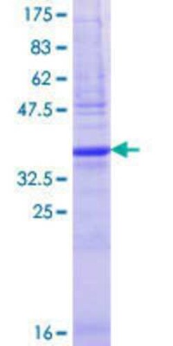 Novus Biologicals Recombinant Human GAGE5 GST (N-Term) Protein 25 &mu;g | Buy Online | Novus Biologicals&trade; | Fisher Scientific