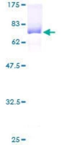 Novus Biologicals Recombinant Human GAK GST (N-Term) Protein 10 &mu;g | Buy Online | Novus Biologicals&trade; | Fisher Scientific