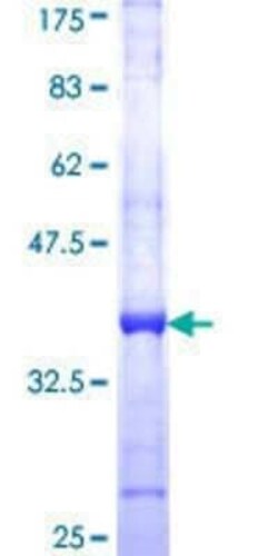 Novus Biologicals Recombinant Human GALK2 GST (N-Term) Protein 2 &mu;g | Buy Online | Novus Biologicals&trade; | Fisher Scientific