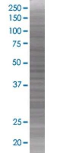 Novus Biologicals&trade;&nbsp;Polypeptide GalNac Transferase 3/GALNT3 293T Cell Transient Overexpression Lysate