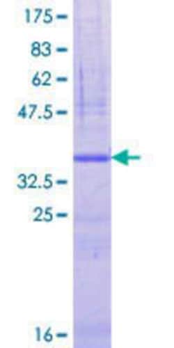 Novus Biologicals Recombinant Human GANC GST (N-Term) Protein 25 &mu;g | Buy Online | Novus Biologicals&trade; | Fisher Scientific